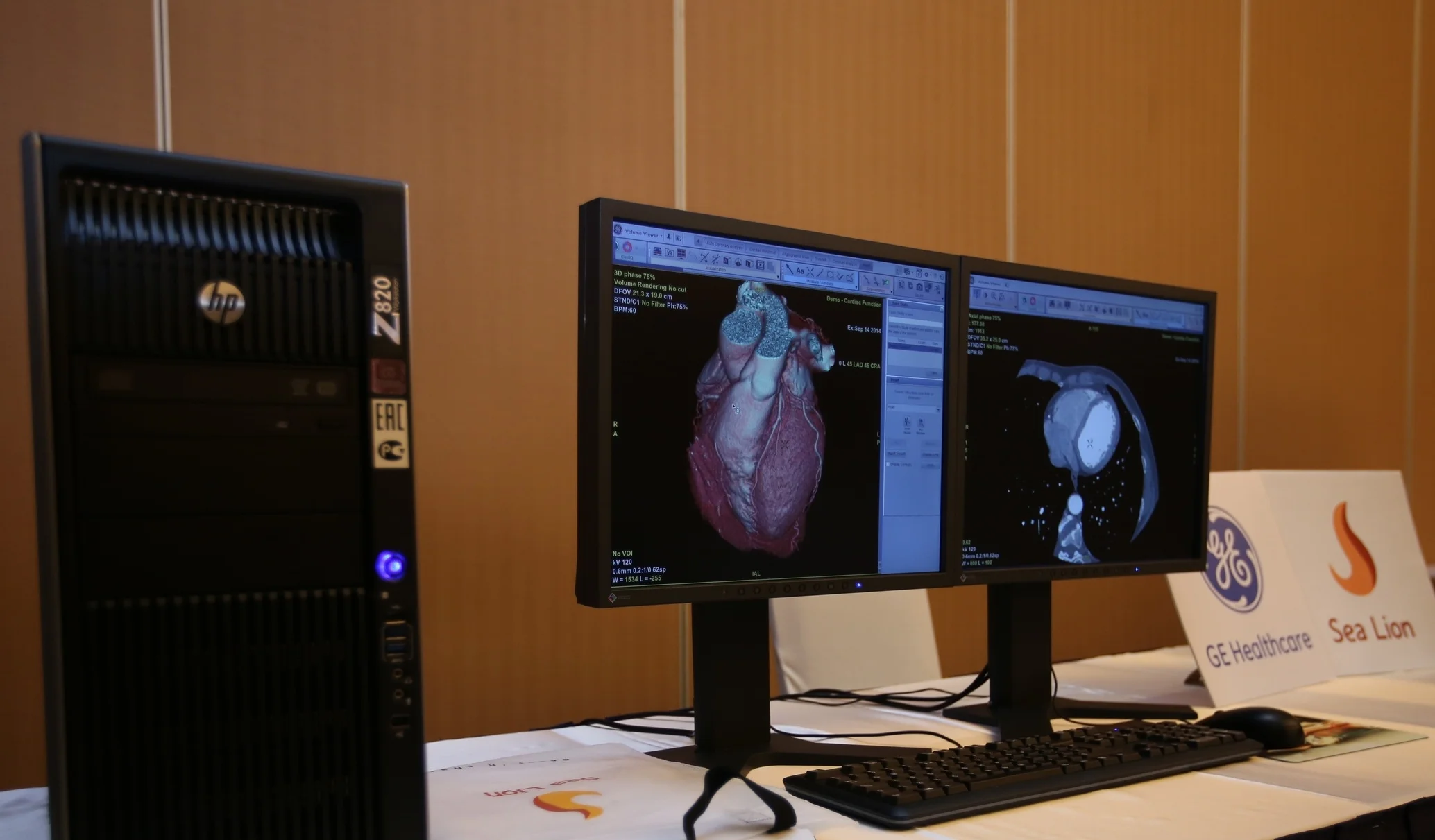GE Healthcare's Multi-Modal Advanced Workstation