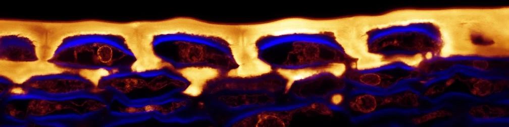 confocal composite.JPG