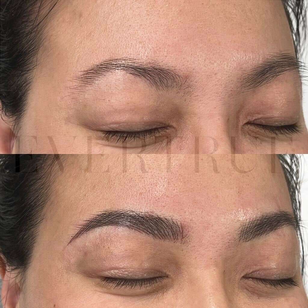 Your brows, your choice! What&rsquo;s the best technique for you? Bespoke Brow Microblading uses individual strokes to replicate brow hairs. Combination Brows does the same, but adds shading for more depth and definition. And of course we can help yo