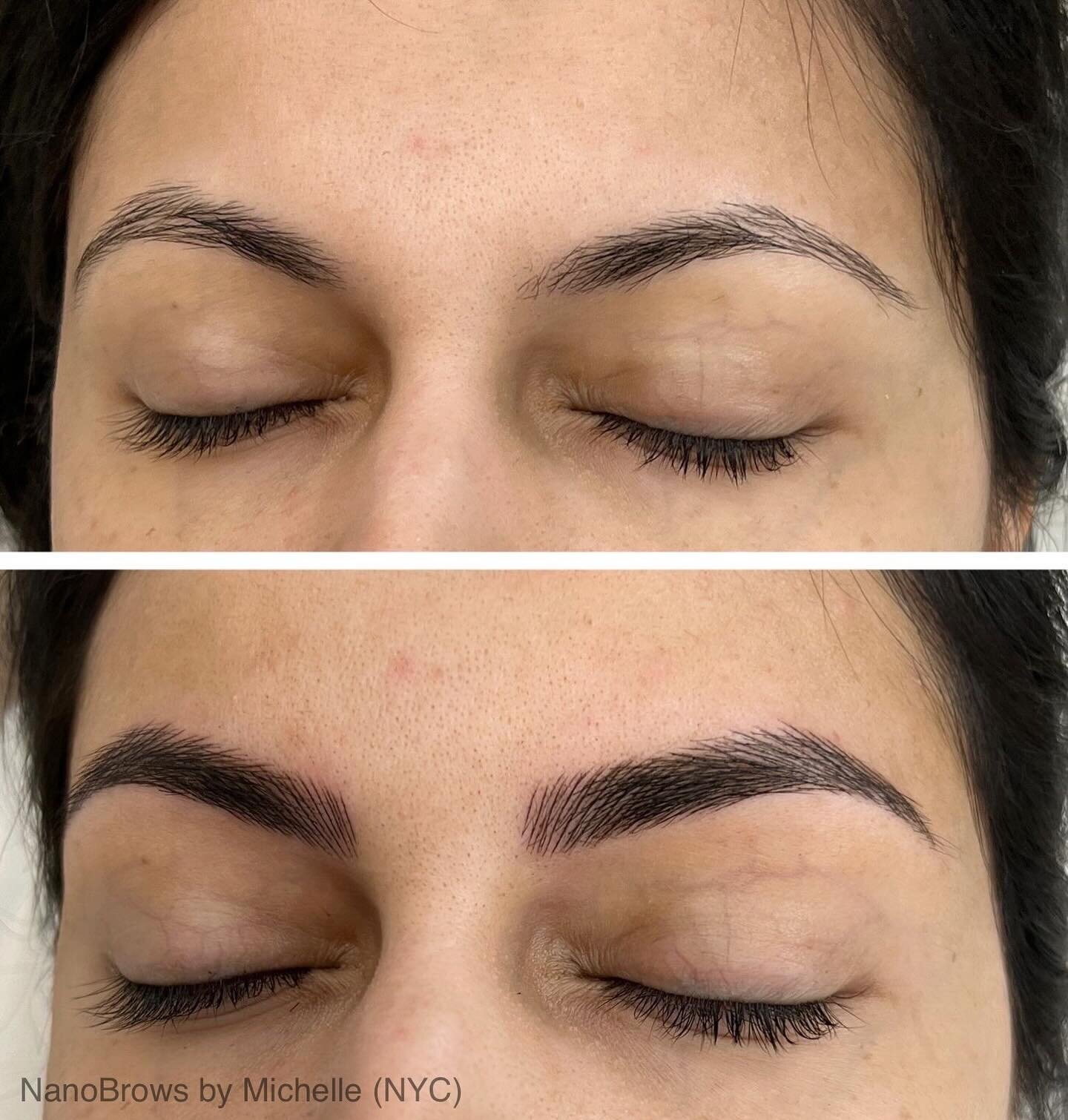 The brows you&rsquo;ve dreamed of! Crisp natural looking strokes created with our NanoBrows technique create this enhanced brow&hellip; still you but better. 
.
Our NanoBrows treatment uses a single very fine needle for very natural-looking results, 