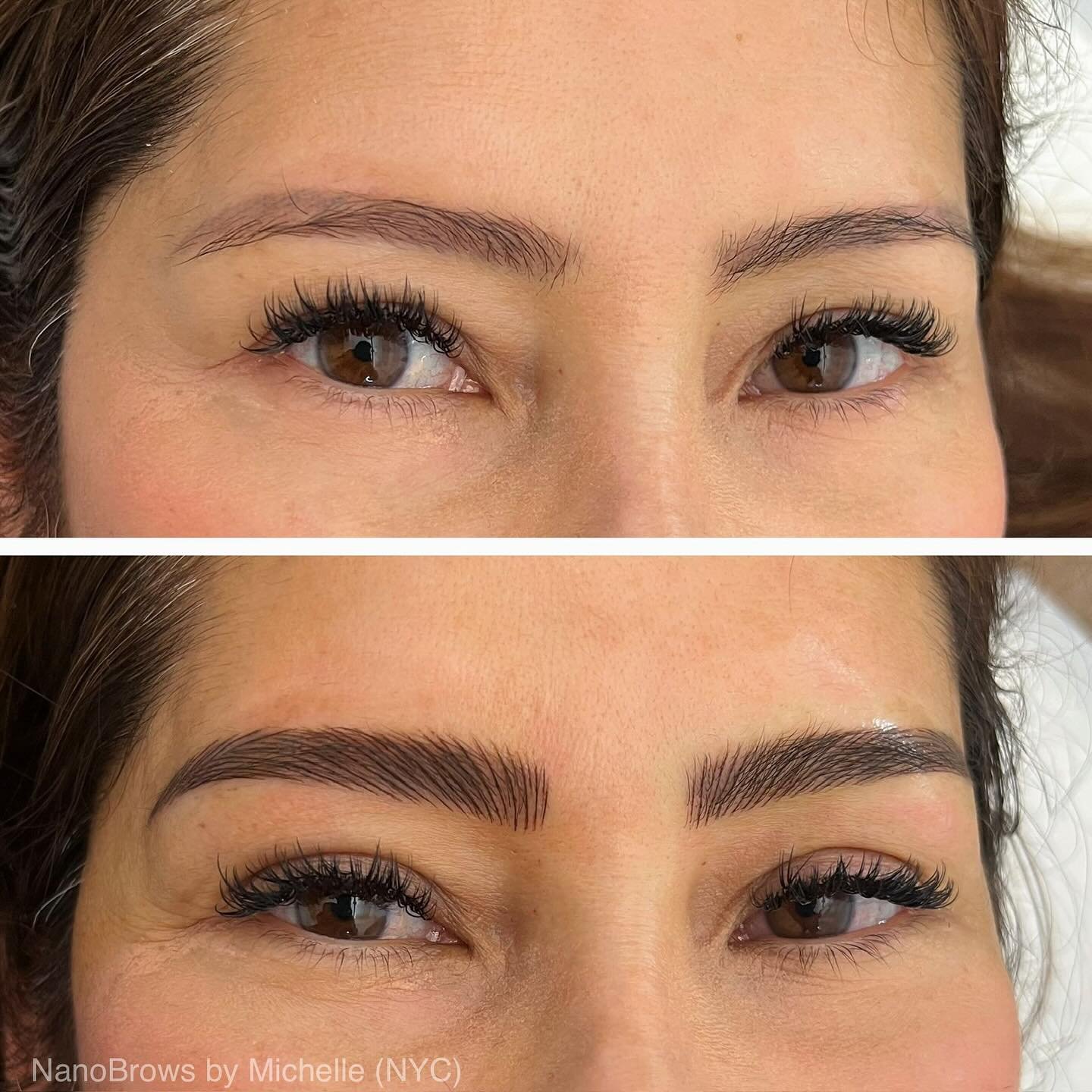 NanoBrows! Beautiful natural-looking brow hair strokes are created using a single fine needle, for the utmost in realism. This is our most advanced and gentlest treatment. 
.
The single fine needle also results in minimal invasiveness: no bleeding, v