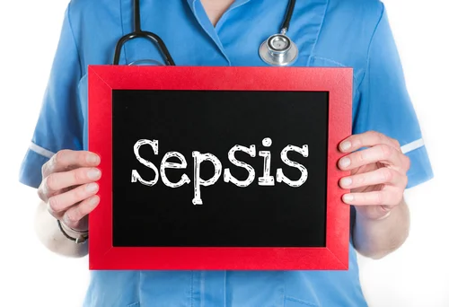SEPSIS: Lecture with Dr. Stuart