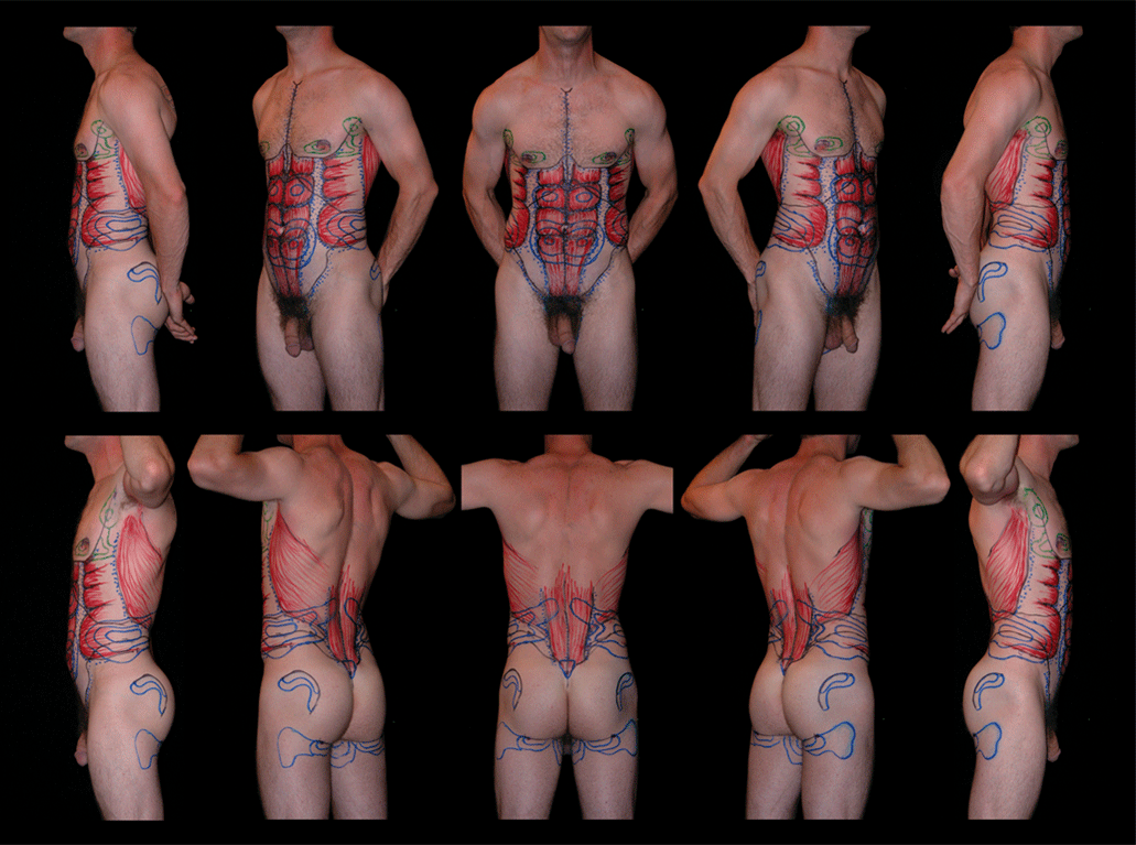 Teplica-Marked-Surgical-Plan.gif