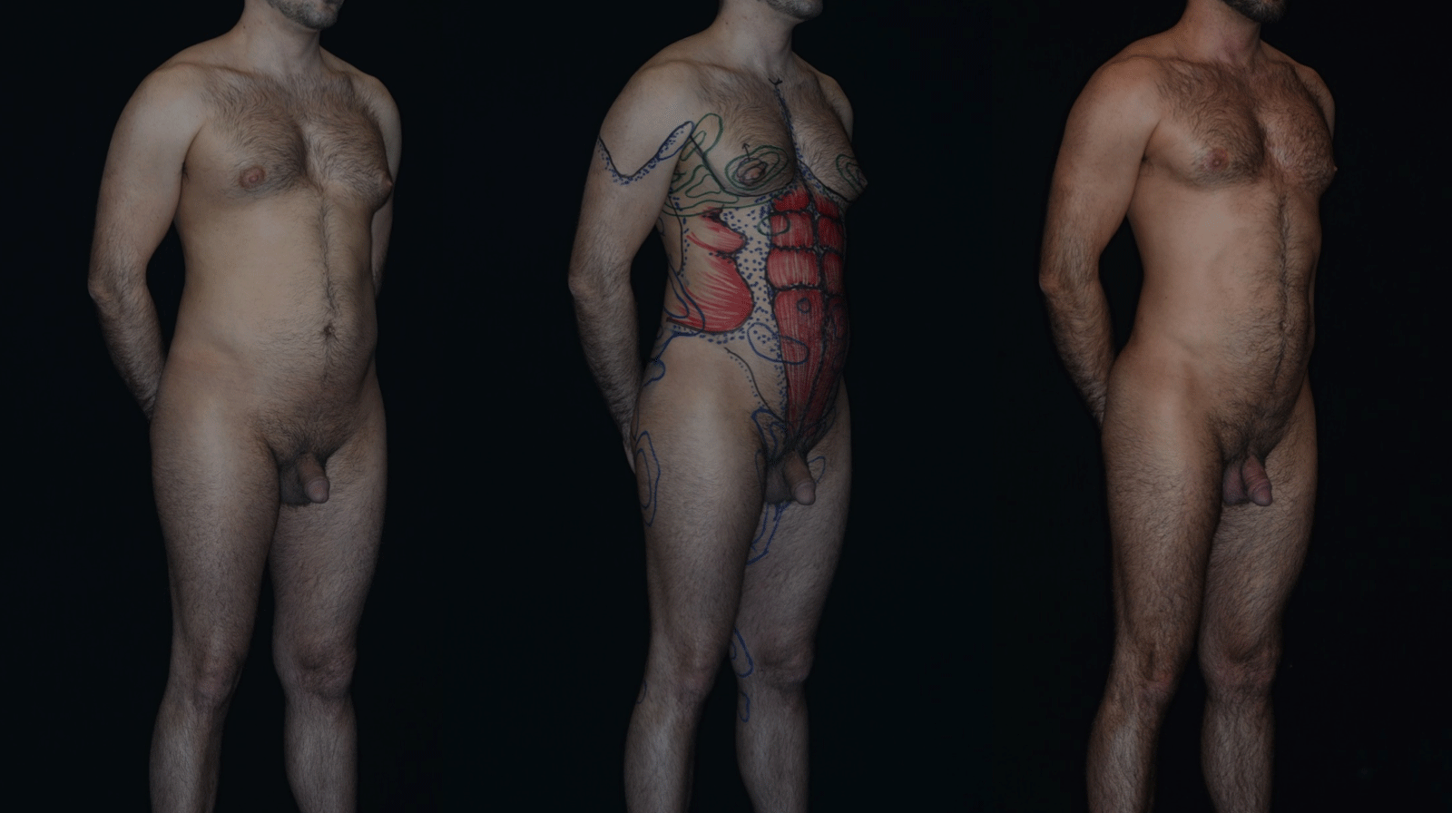 Teplica-Circumferential-Masculinization-45-Degrees.gif
