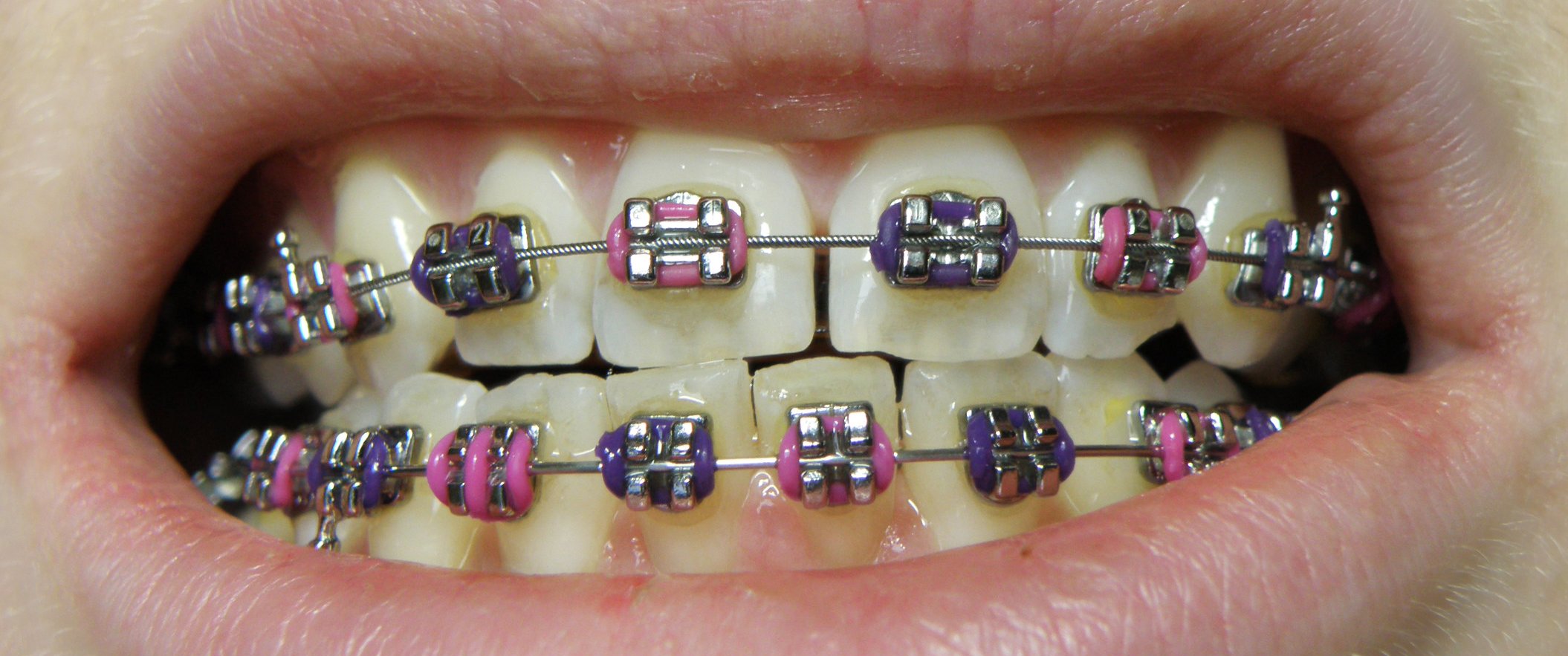 What is orthodontic Treatment?- By Dr Amir Mostofi DDS, Dip. MSc