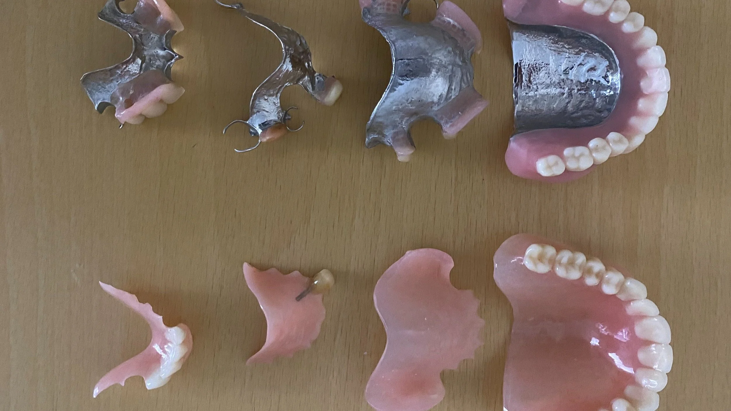 What are differences between fully acrylic and Cobalt- Chrome dentures? - By Dr Amir Mostofi DDS, Dip. MSc. 