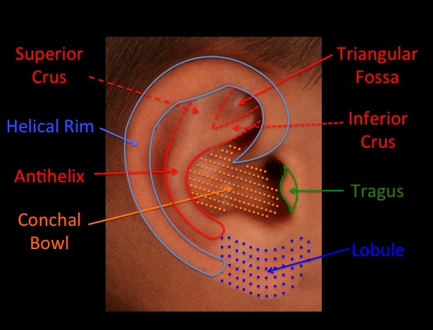 Otoplasty (Ear Surgery) — Dallas Plastic Surgeon specializing in