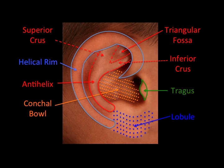 The antihelix, outlined in RED, splits into the superior and inferior crus, giving the antihelix a curved Y-shape.