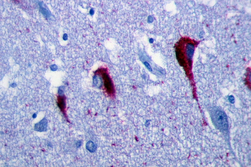 Figure 1. The use of immunohistochemistry to visualize neurons in hippocampus tissue