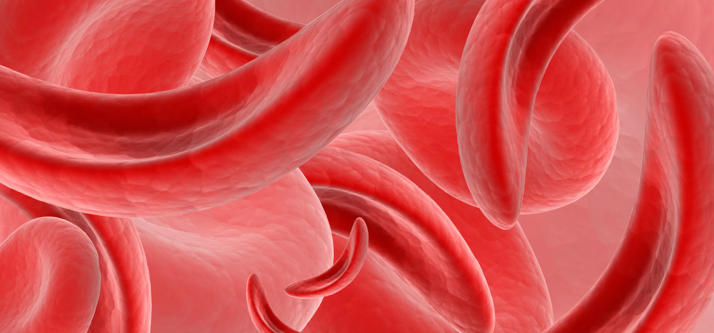Sickle Cell.jpg