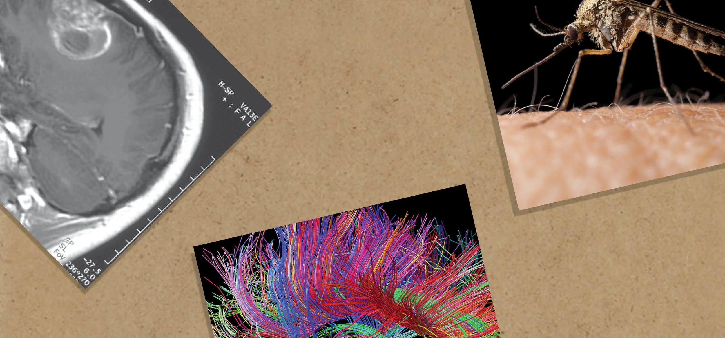 Banner Zika.jpg