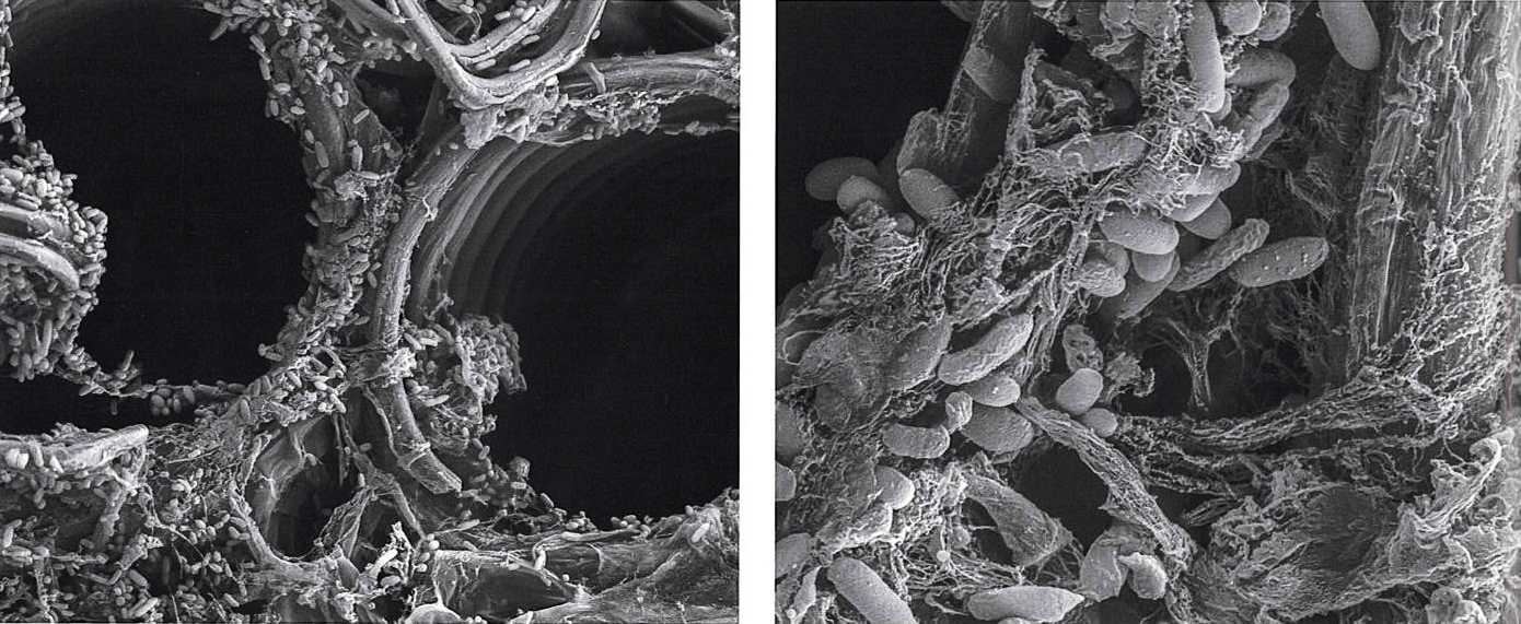 Copy of Inspirational Scientific Imagery: Electron micrograph of Bacteria lining the interior surface of a plant. 2000x magnification (LHS) 5000x magnification (RHS)