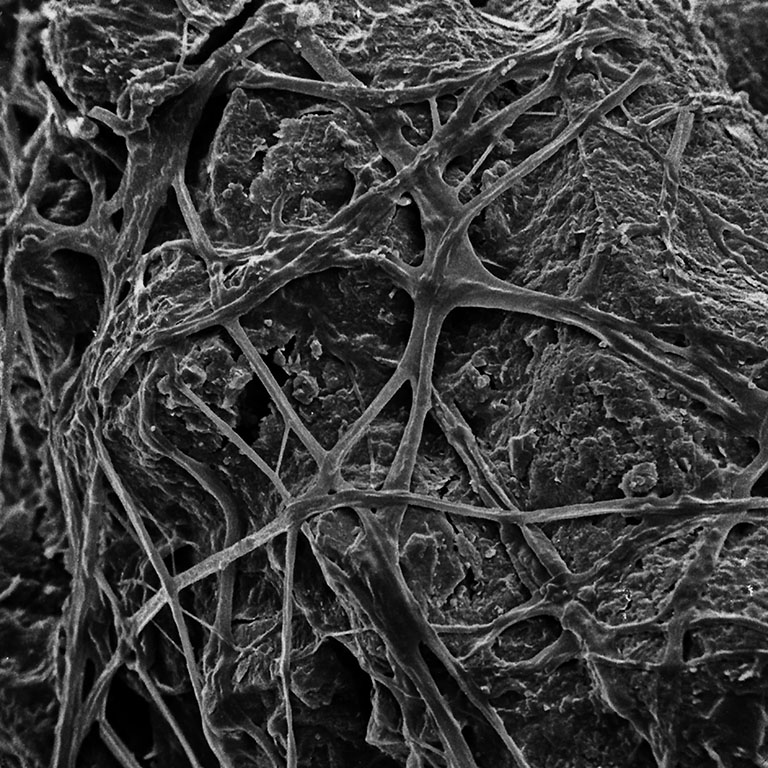 Copy of Inspirational Scientific Imagery: 2000x Magnification of fungal web surrounding a soil particle. Electron micrograph by Thilo Eickhorst.