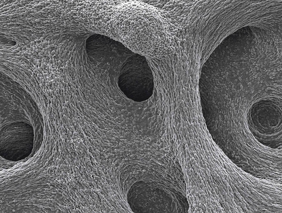 Copy of Inspirational Scientific Imagery: 2000x electron micrograph of cavernous bacterial structures..