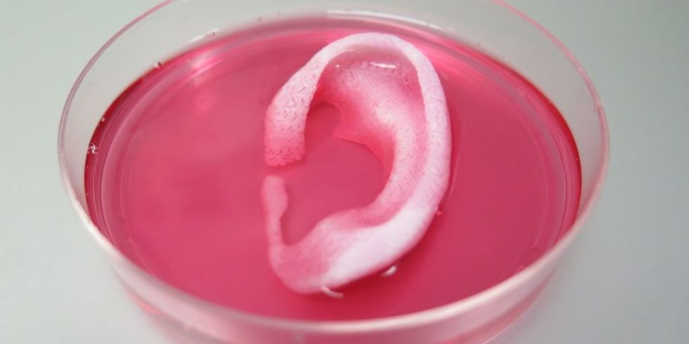 3D printed cartilage ear