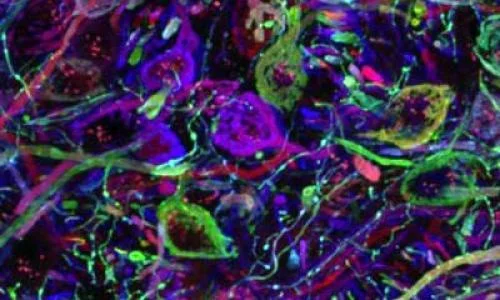 neurons in auditory pathway of brainstem.jpg