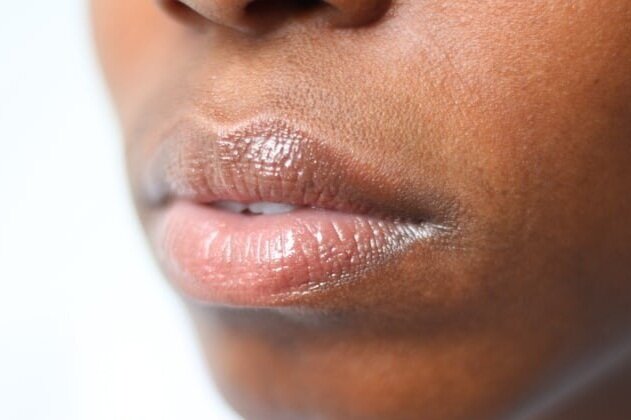 This Balm Heals Dry Skin and Chapped Lips Fast