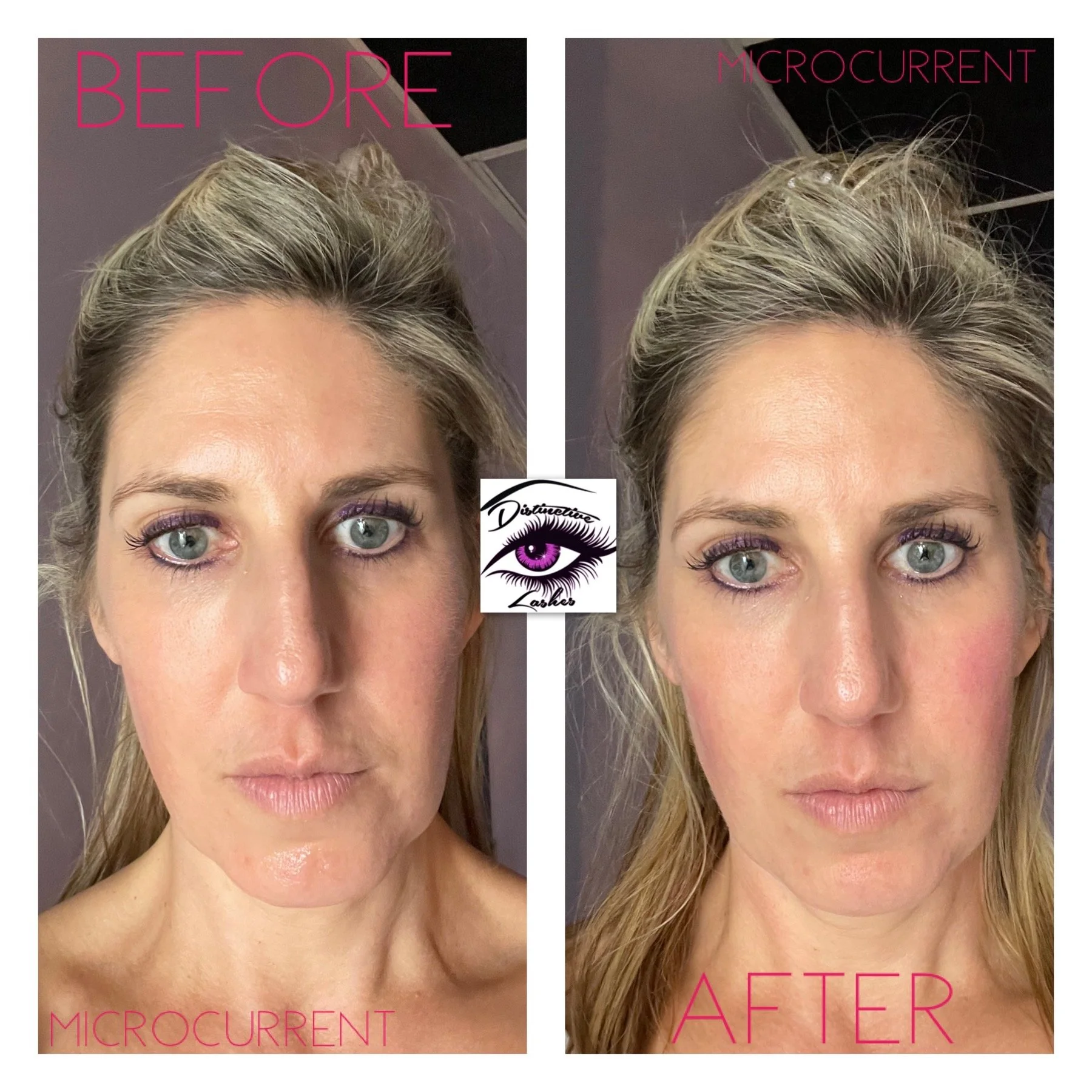 NeedleLess Lip Fillers, Hyaluron Pen Eyelash Extensions , Ombre Brows