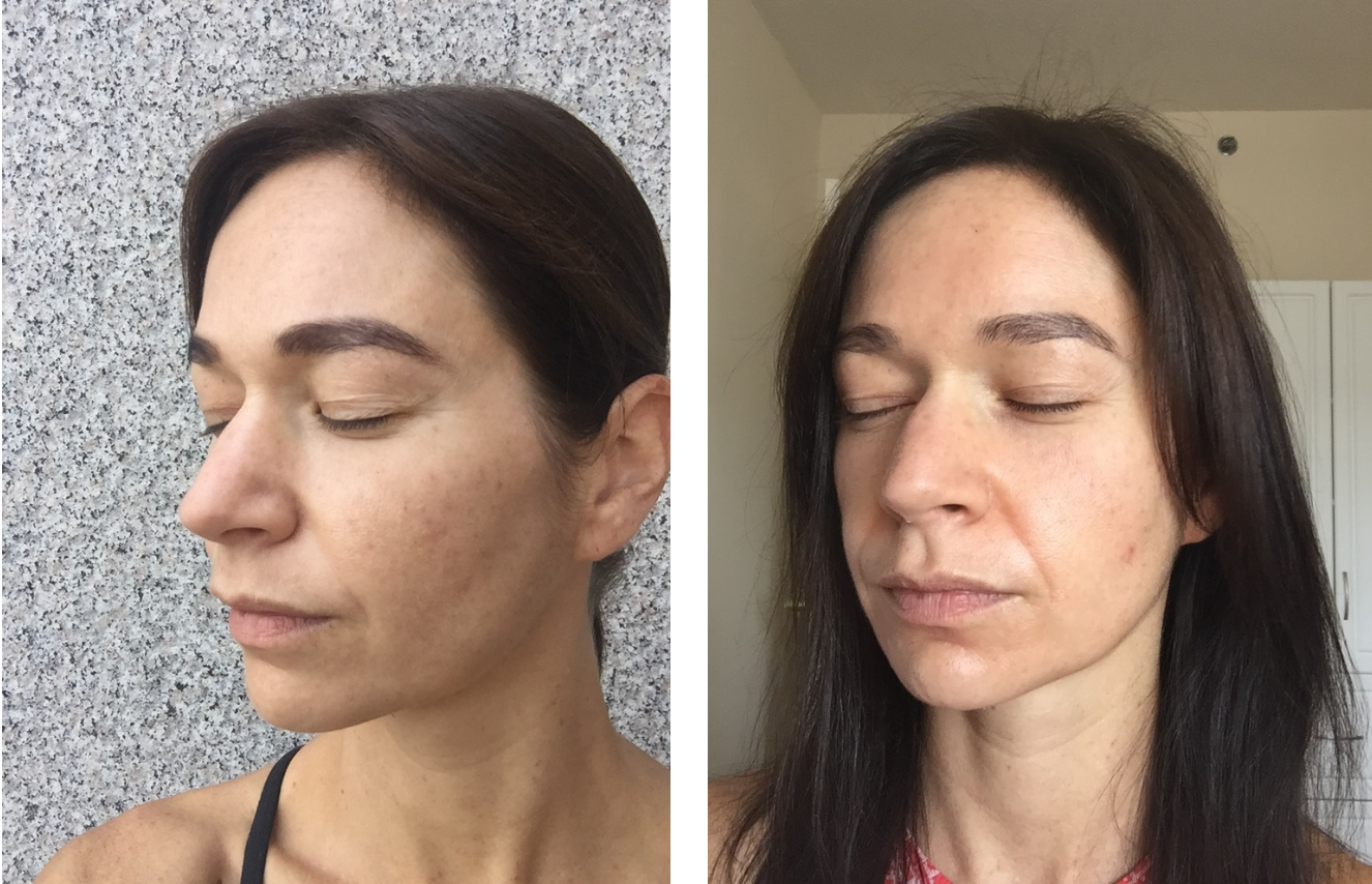 Tried It: Vi Peel