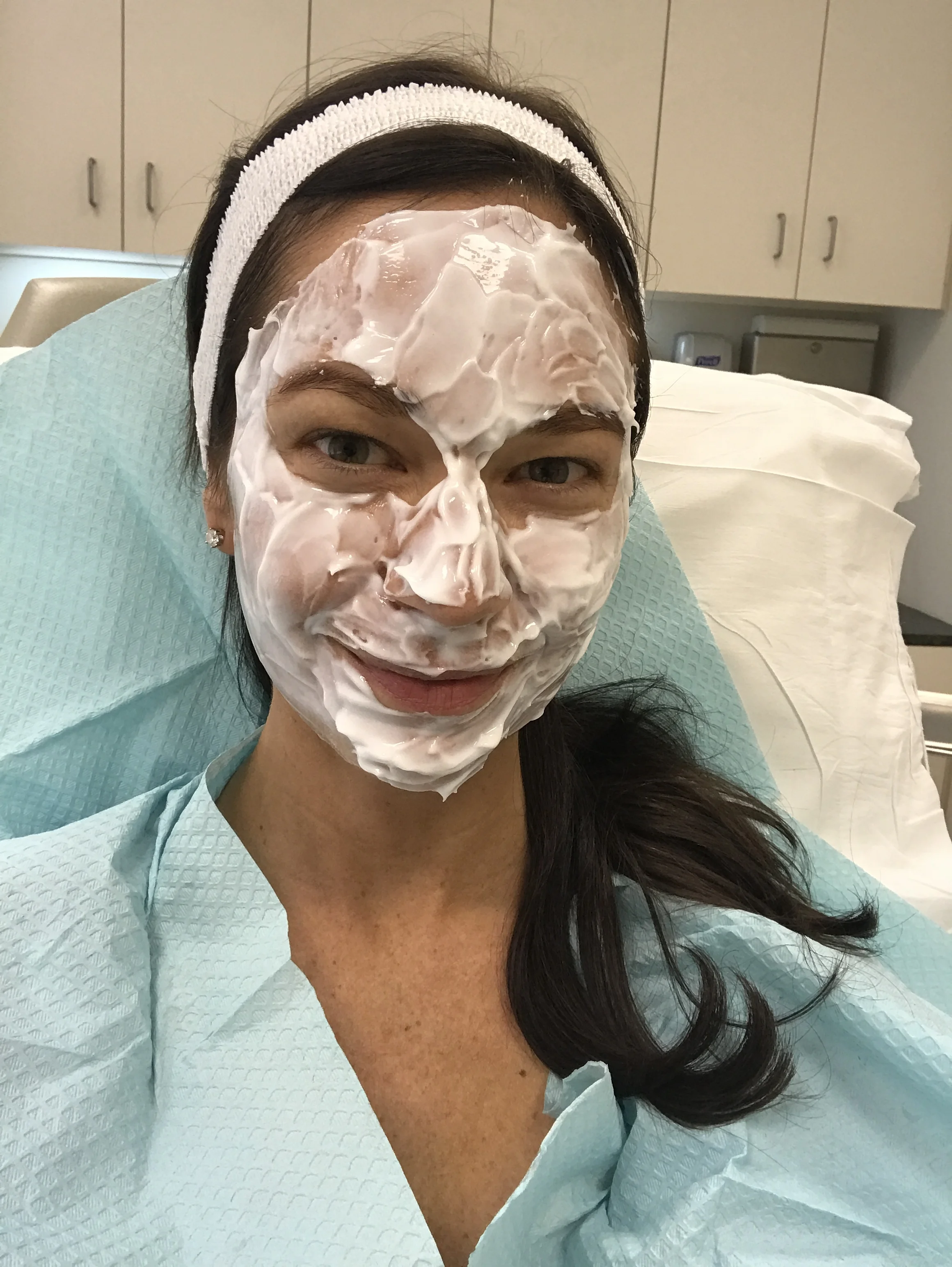 A Laser Treatment with No Downtime