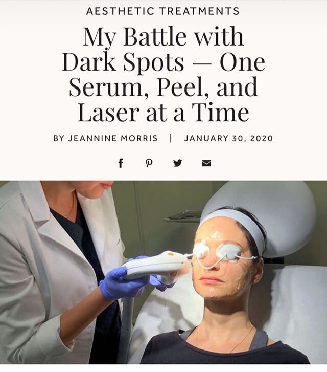 Hyperpigmentation is perhaps the most frustrating skin condition to try to get rid of. In my latest for @spotlyte I share all of my editor&mdash;approved ways to battle it. Thanks @adrianalombardimd of @sccsnj for helping! 👆🏼Link in profile. *
*
*
