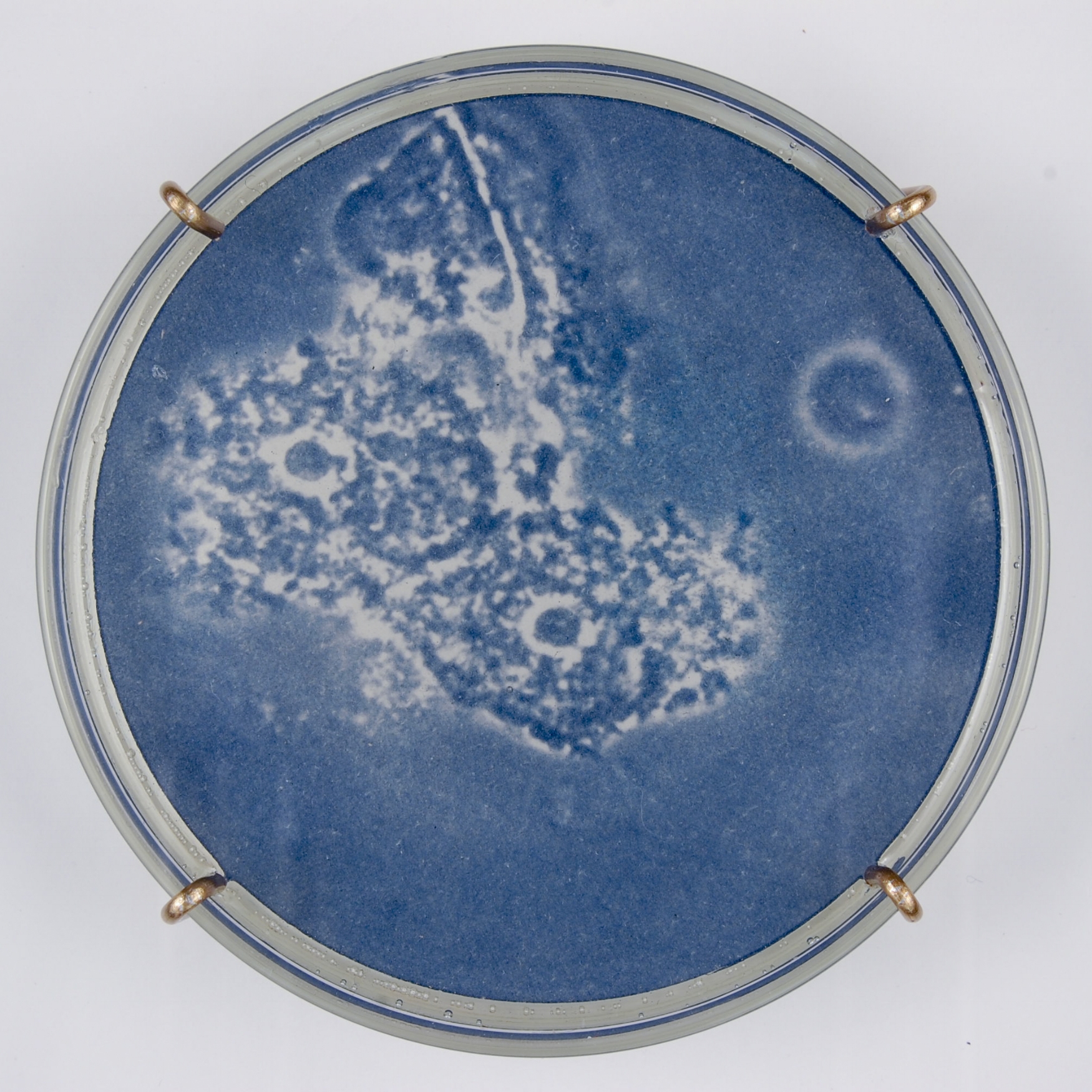Bacterial vaginosis I (detail)