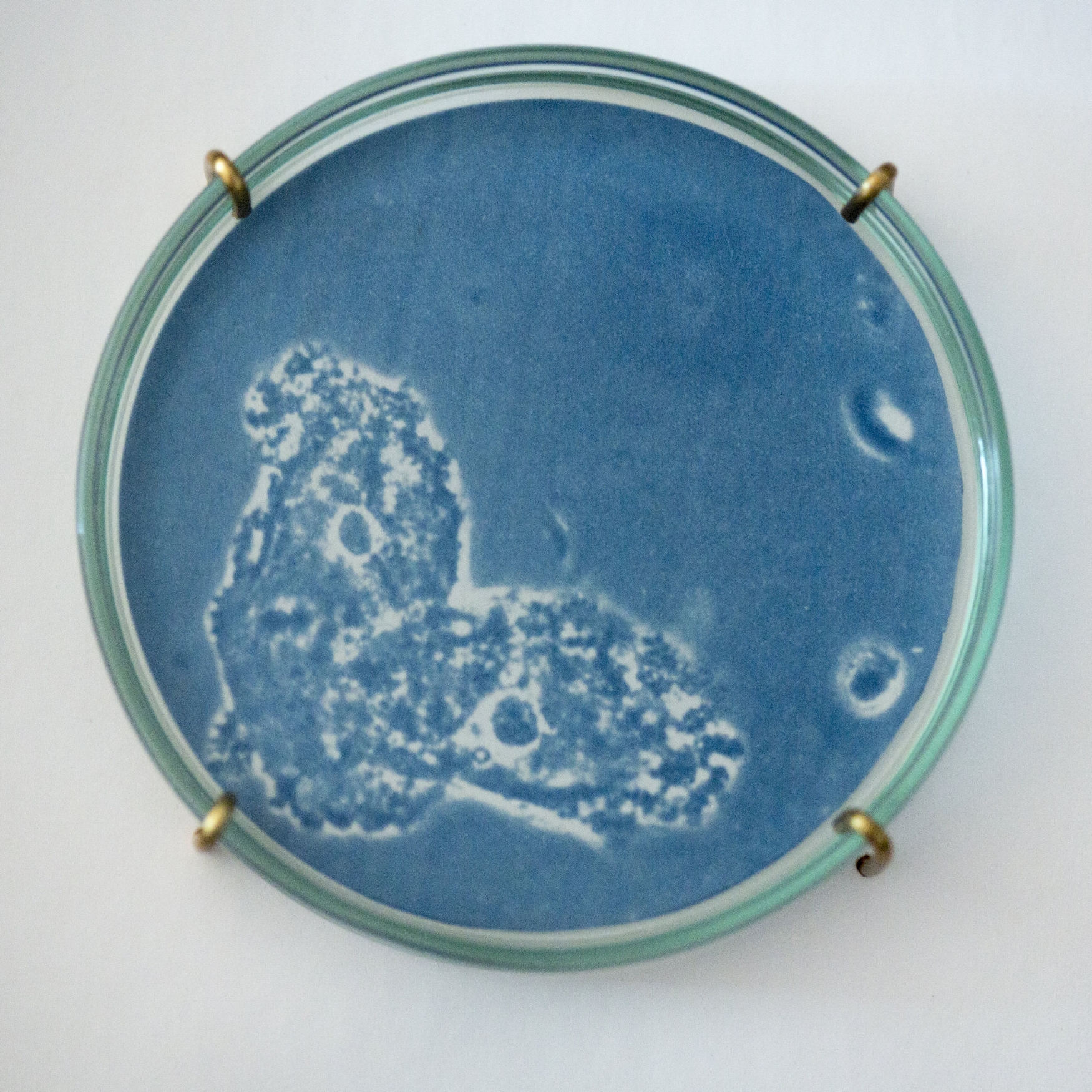 Bacterial vaginosis II (detail)