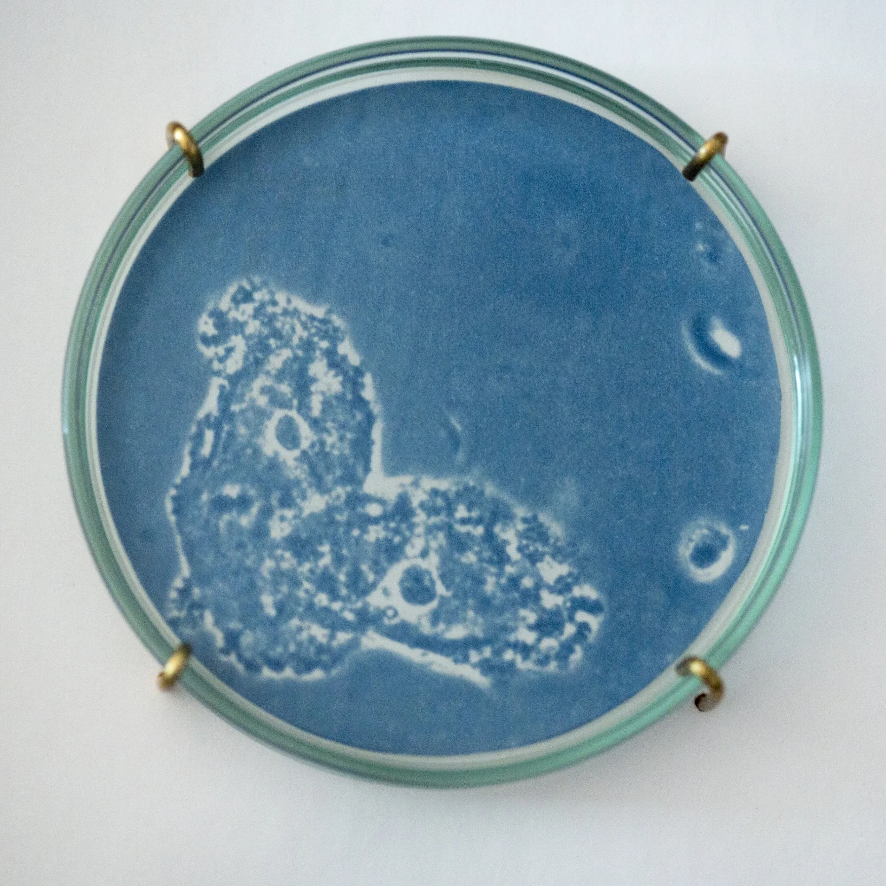 Bacterial vaginosis II (detail)