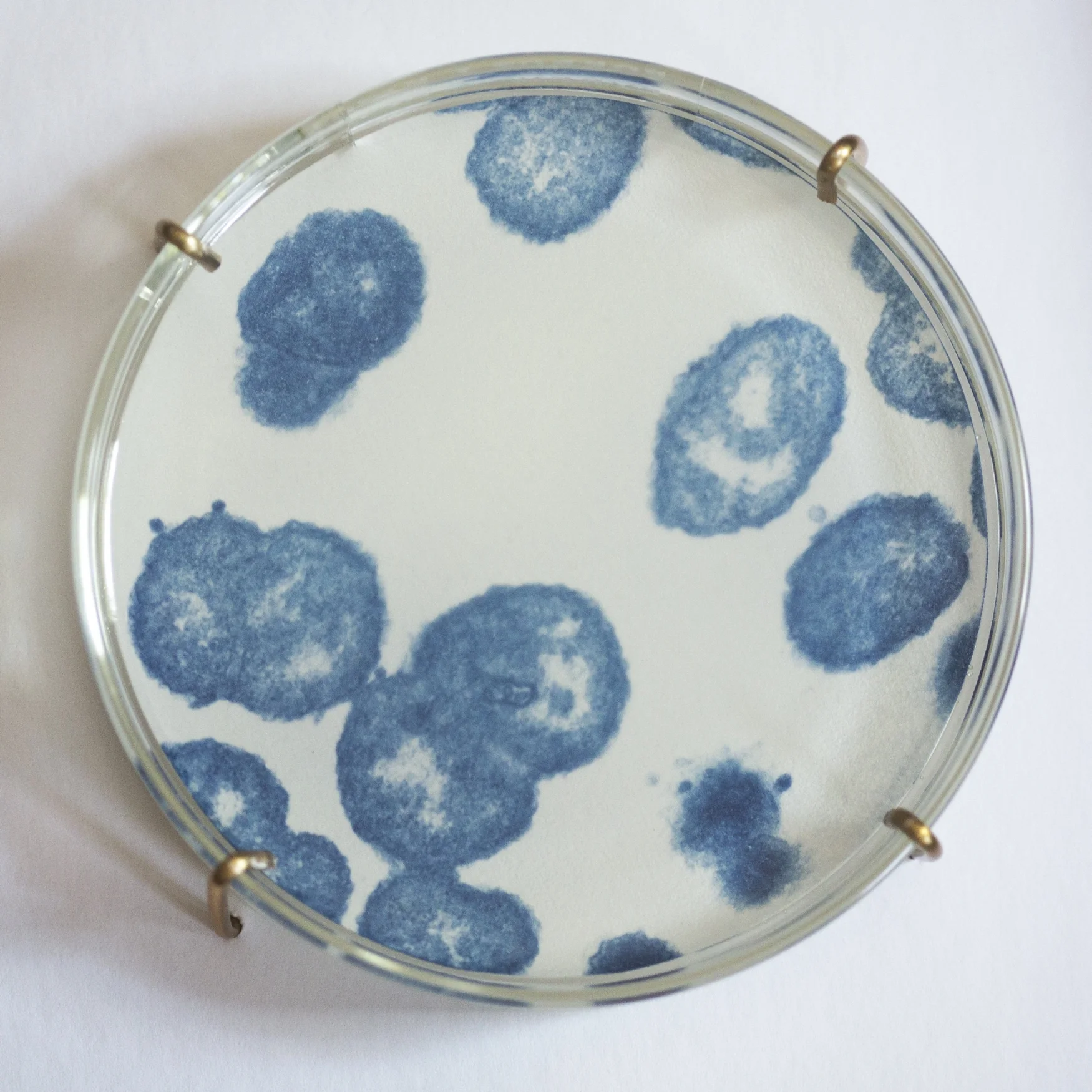 Neisseria gonorrhoeae IV (detail)