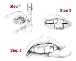 what to do.jpg