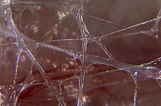 Image of fascia by Dr. J.C. Guimberteau