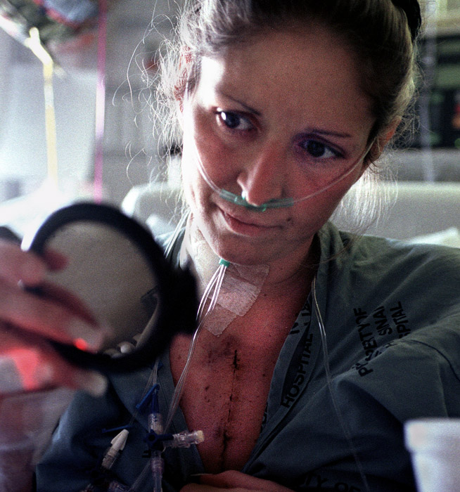 A mere six hours after her surgery, Lisa see her scar for the first time.
