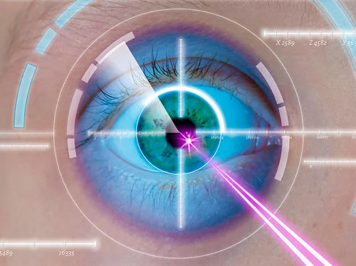 LASIK 2.jpg