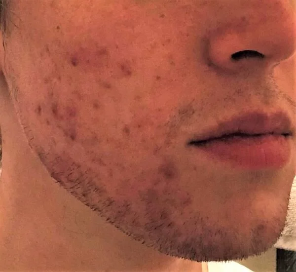 right side now sm.jpg