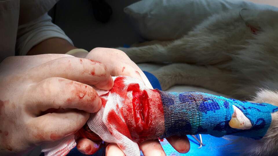Louis' surgery (cut by string)