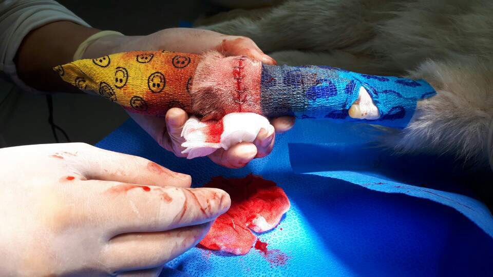 Louis' surgery (cut by string)