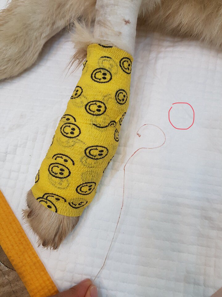 Louis' surgery (cut by string)