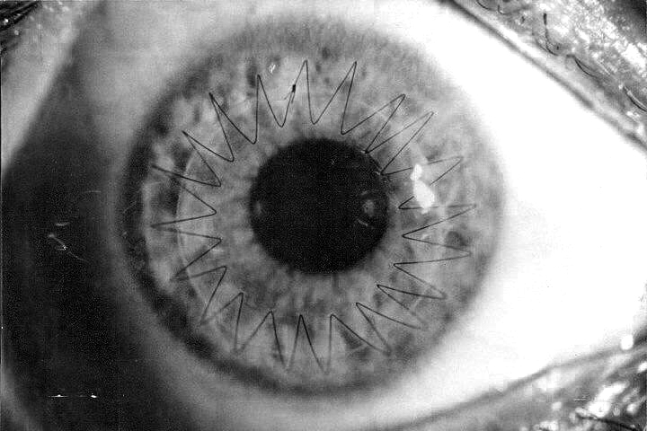 Terries EYE.jpeg