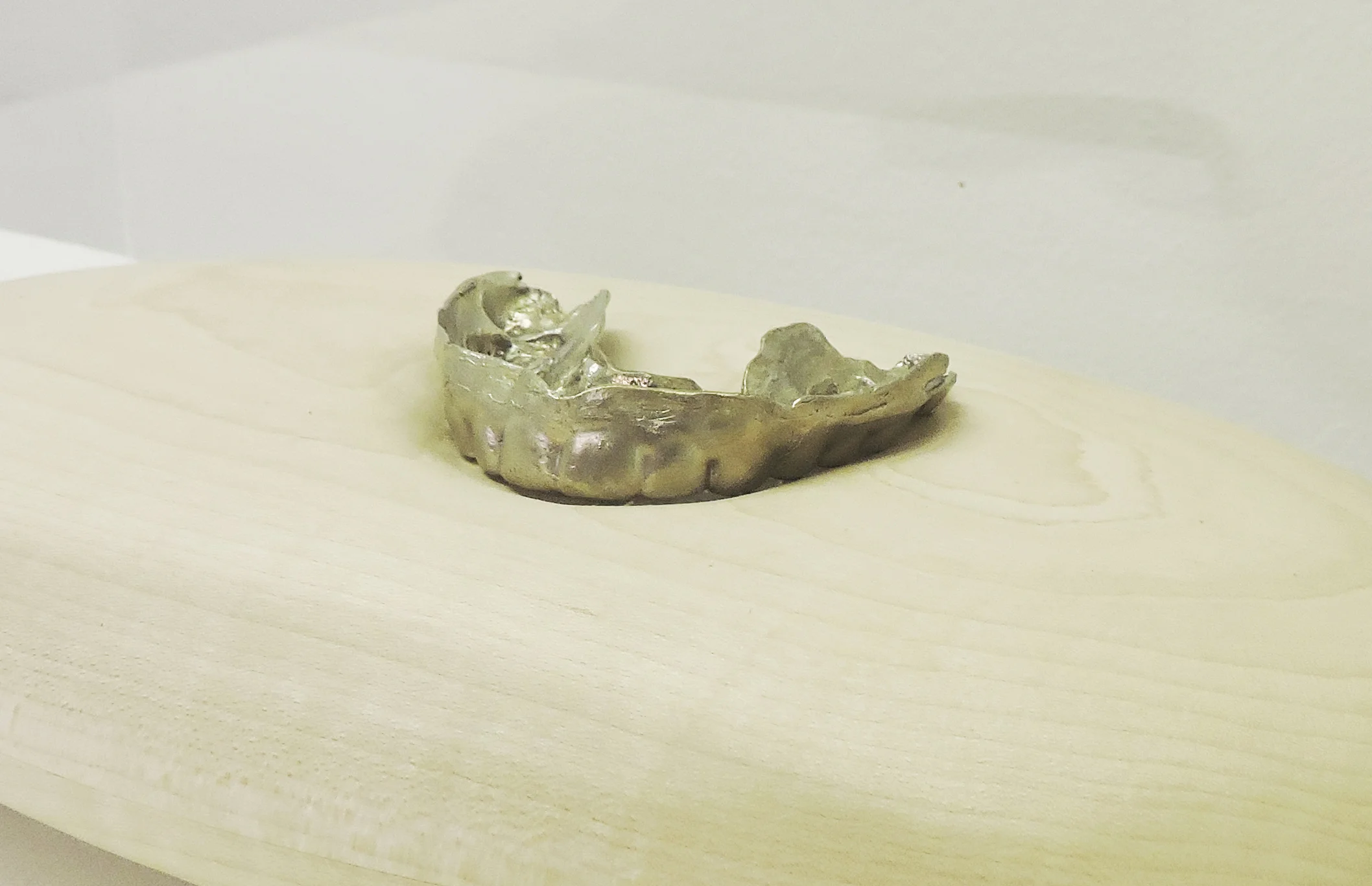 Partner's Retainer (detail)