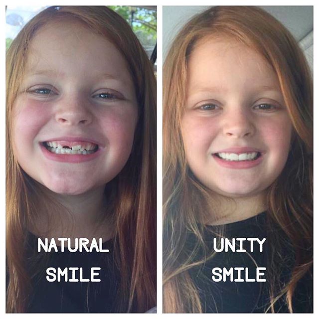 Elle Grace has an adorable natural smile...but when it's time to hit the stage, she sparkles in her Unity Smile. #unitysmile #pageantflipper #pageantgirl #pageantsmile #shareyoursmile