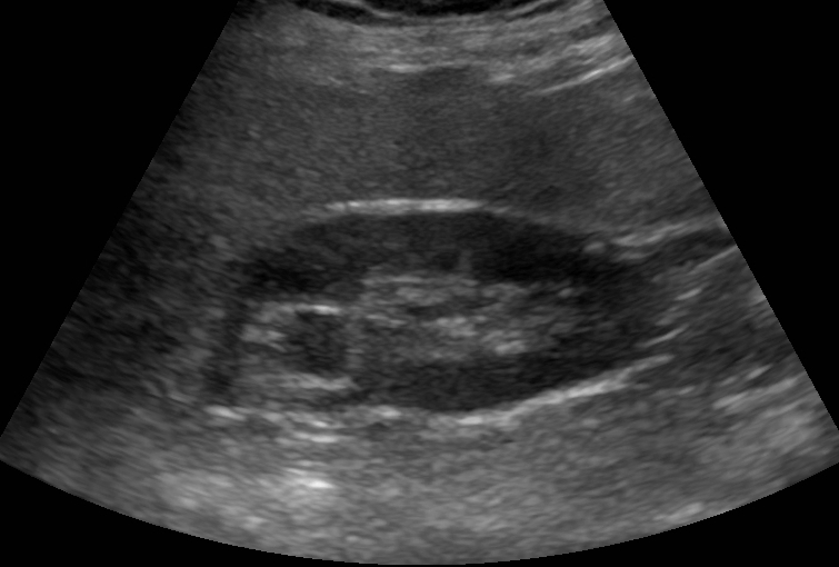 This is not my ultrasound. In fact, this might not even be from a human.