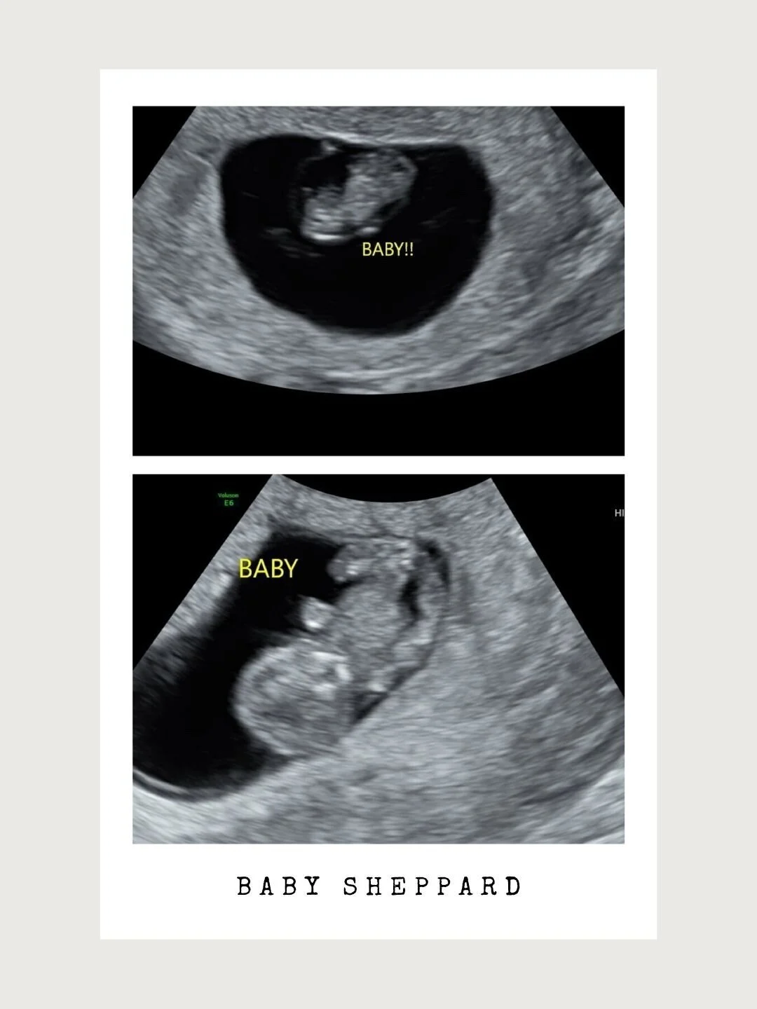 We Are Having A Baby! Our Pregnancy Story + How We Found Out