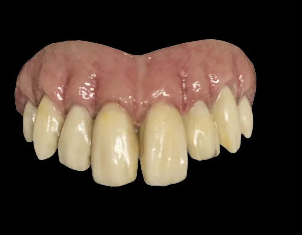 Trick or Treat Studios - Bitemares Horror Teeth Appliance Goofy Teeth - Lord Grimley's Manor