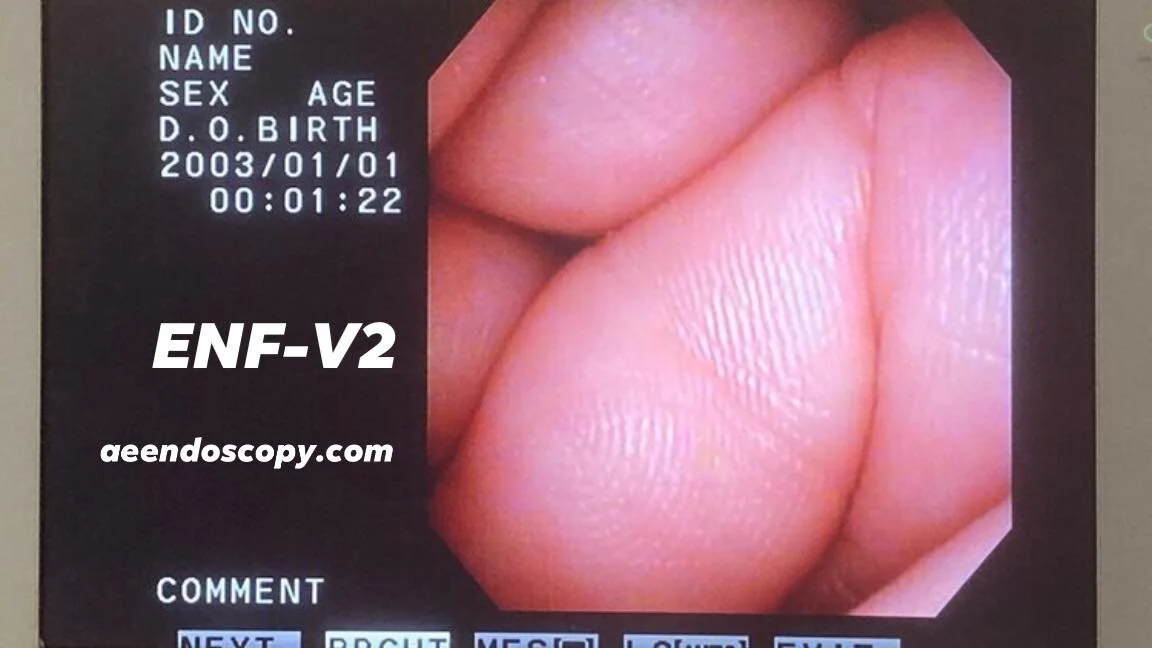 ENF-V2 Video.jpg