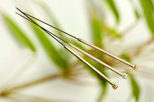 acupuncture.jpg