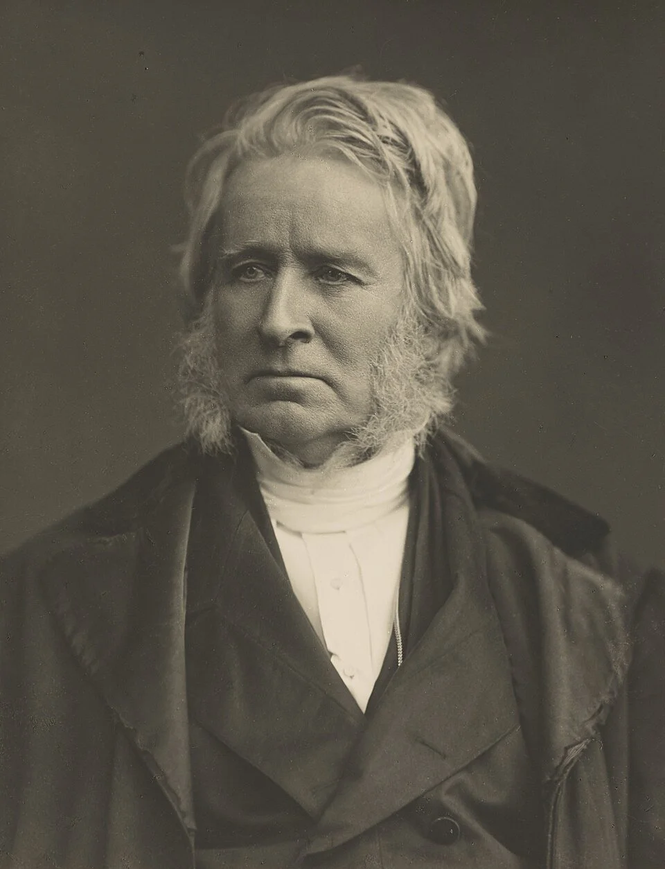 Begg on the Use of the Organ, Preface