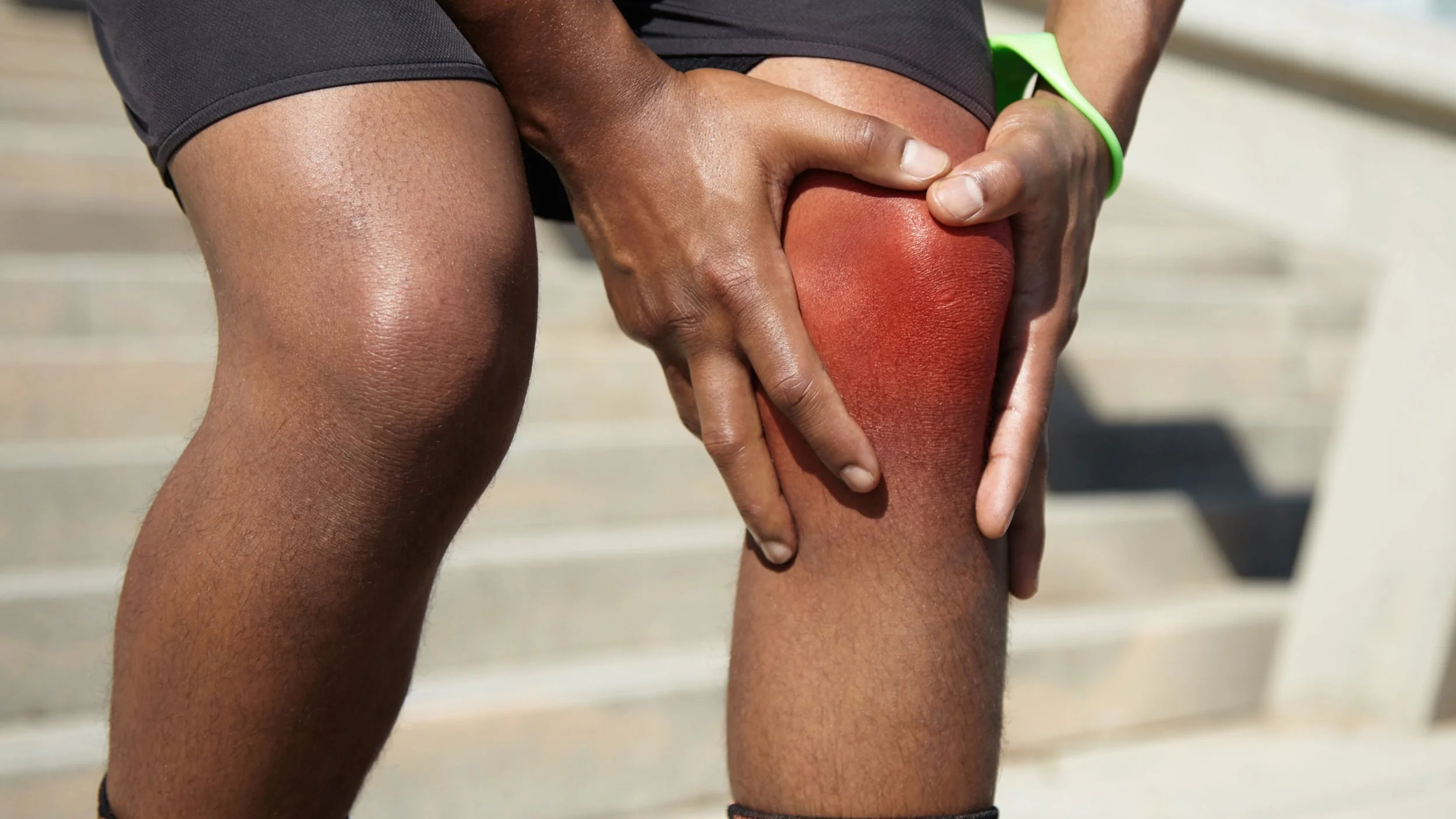 Can Weak Quadriceps Cause Knee Pain?