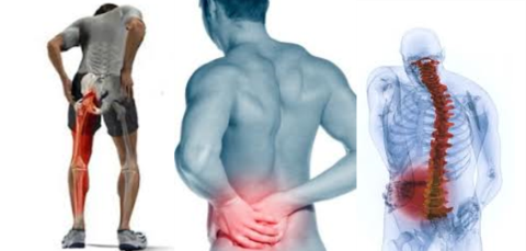 sciatica1_large.png