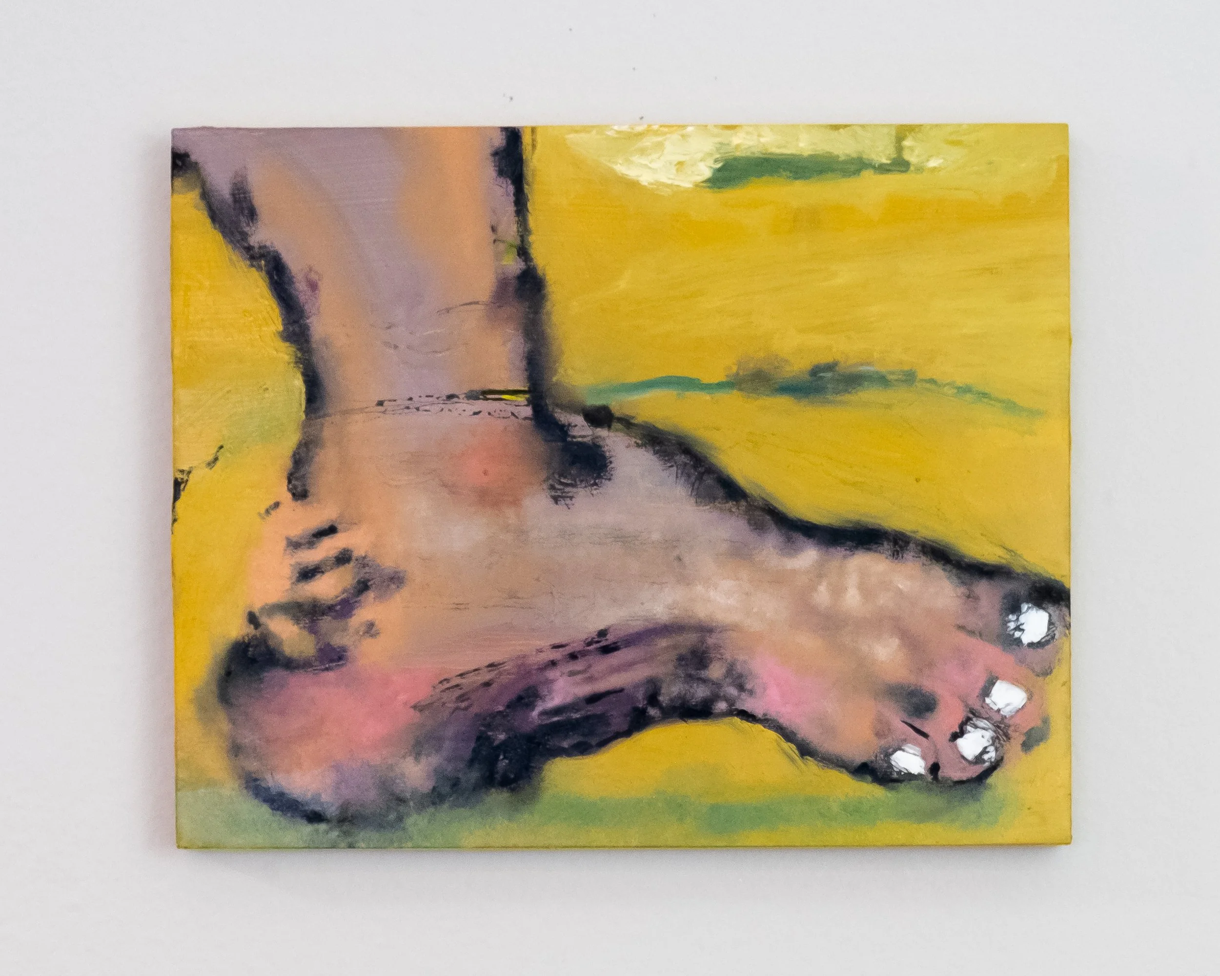 Rotted Foot.jpg