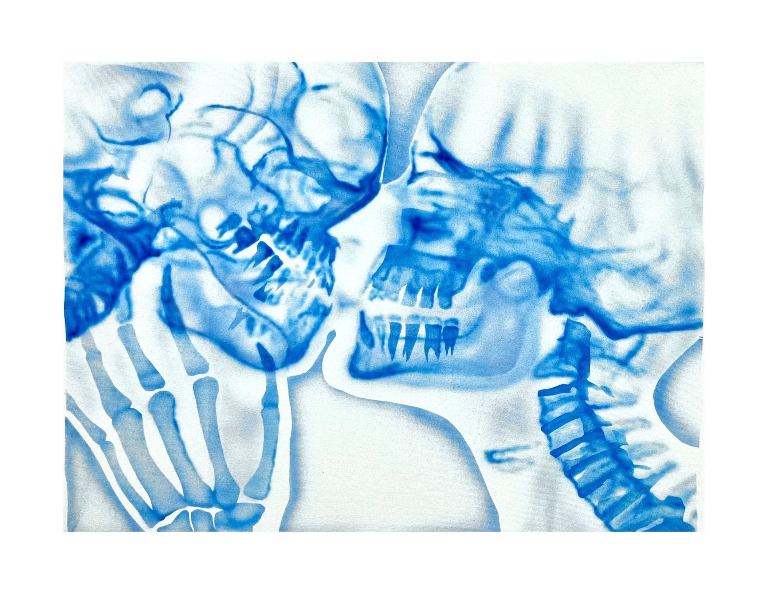 X-ray.jpg